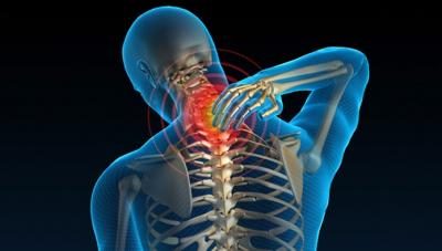 Sự nhầm lẫn giữa thoái hóa đốt sống cổ và đau nửa đầu.