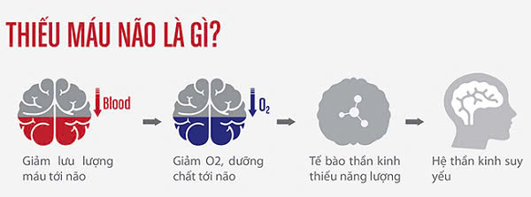 Thiếu máu não dẫn đến nhiều rối loạn trong cơ thể